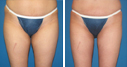 Before & After Photos